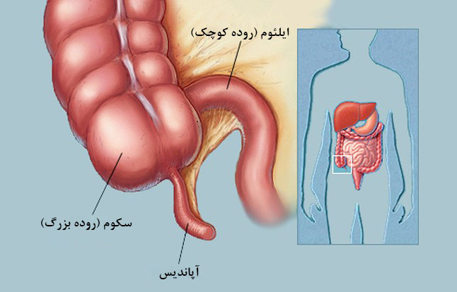 آپاندیس